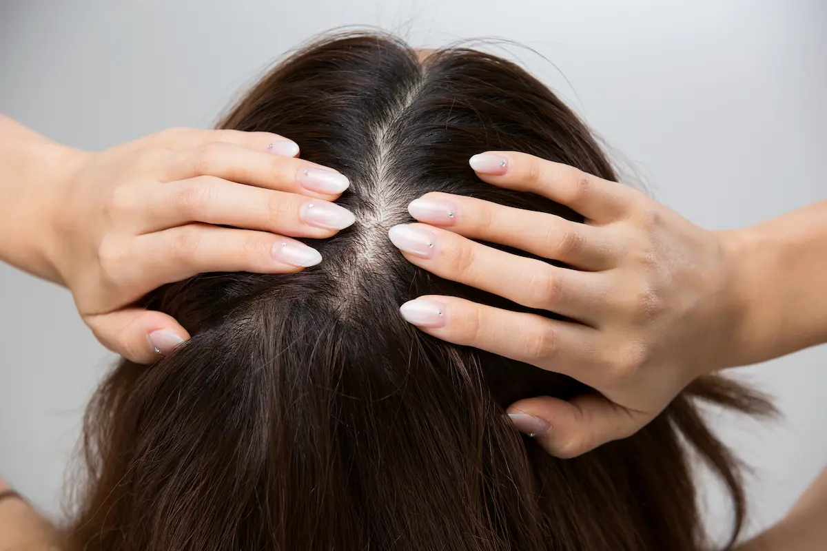 頭皮を押さえる女性